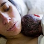 7 cách trị tàn nhang sau sinh tại nhà hiệu quả và an toàn