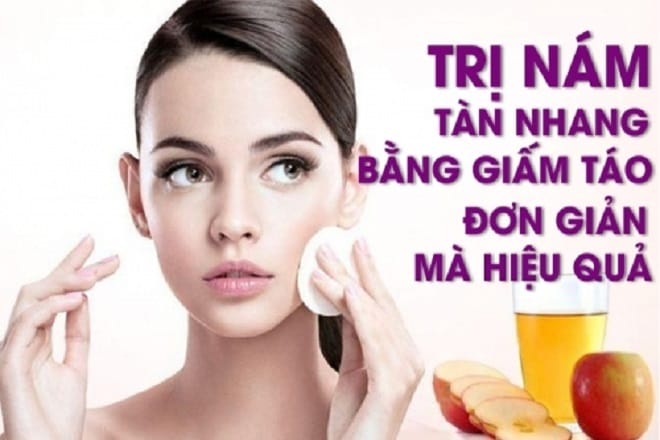 Toner làm mờ tàn nhang bằng giấm táo