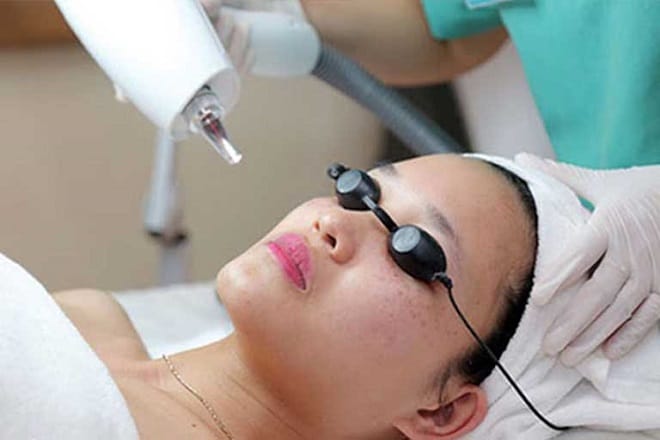 điều trị bằng laser