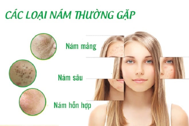 chọn mỹ phẩm theo mức độ nám