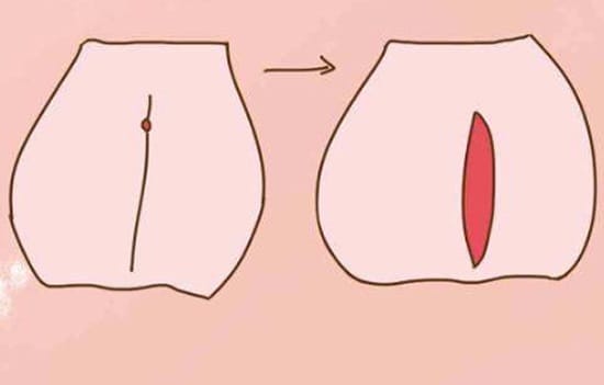 Cô gái từng phá thai, bác sĩ chỉ nhìn thoáng qua đã biết 2 đặc điểm này!  - đầu tiên