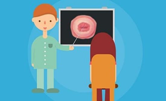 Cô gái từng phá thai, bác sĩ chỉ nhìn thoáng qua đã biết 2 đặc điểm này!  - 3