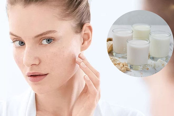 Trị tàn nhang bằng nước vo gạo - Mẹo hay bạn nên biết 206749 anh dai dien tri tan nhang bang nuoc vo gao