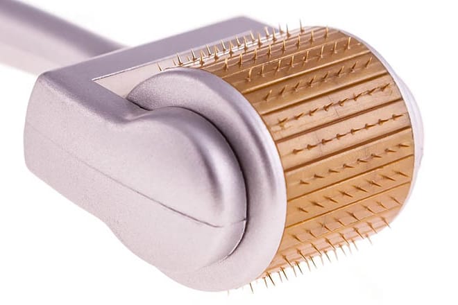 Phương pháp lăn kim trị tàn nhang có an toàn với làn da của phụ nữ Châu Á không? Kim lăn