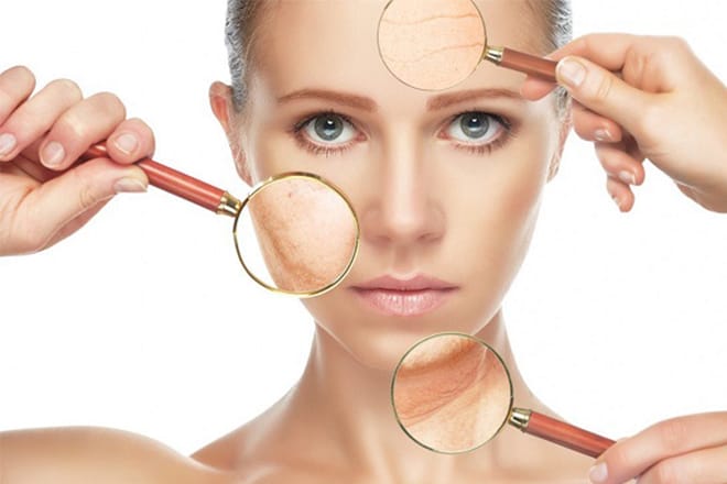 Phương pháp lăn kim trị tàn nhang có an toàn với làn da của phụ nữ Châu Á không? Kiểm tra làn da của bạn