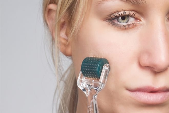 Phương pháp lăn kim trị tàn nhang có an toàn với làn da của phụ nữ Châu Á không? Lăn kim tại nhà