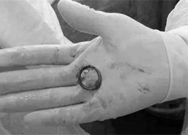 Bà mẹ 59 tuổi đau dữ dội vùng hạ vị, phải nhập viện kiểm tra, bác sĩ mắng mỏ không ngừng - 3