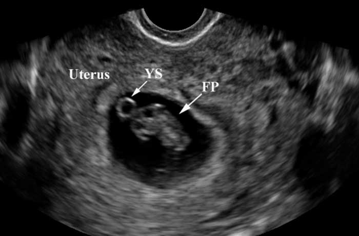 Trang trí bong bóng | Dịch vụ tạo hình bong bóng xinh nghệ thuật