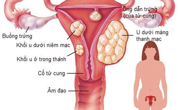 Trang trí bong bóng | Dịch vụ tạo hình bong bóng xinh nghệ thuật