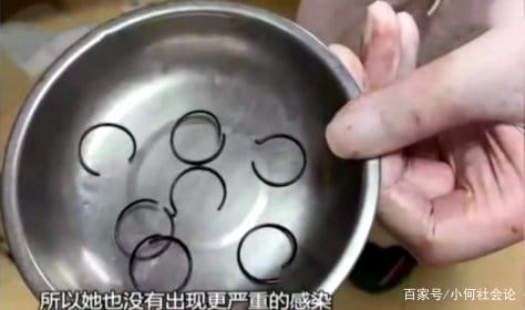 Nữ sinh nghĩ ra cách nhét dị vật vào amp; # 34; hạ sĩ; # 34 ;, bác sĩ chỉ biết ngao ngán - 4