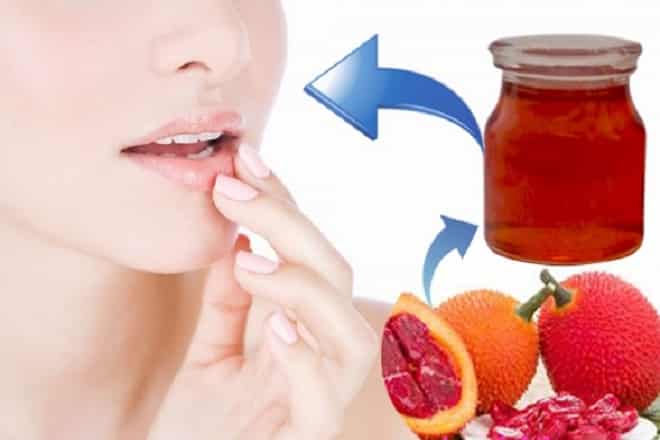 9 cách hết thâm môi nhanh chóng tại nhà chỉ sau 1 đêm Dầu gấc trị thâm môi